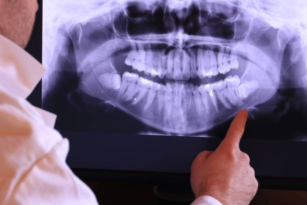 Best Same-Day Emergency Dental Services in Vandercook Lake, MI