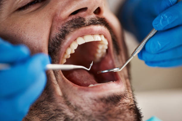 Best Same-Day Emergency Dental Services in Vandercook Lake, MI